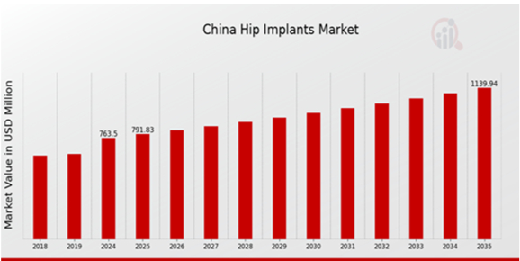 China Hip Implants Market Overview