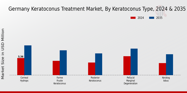 Germany Keratoconus Treatment Market Segment