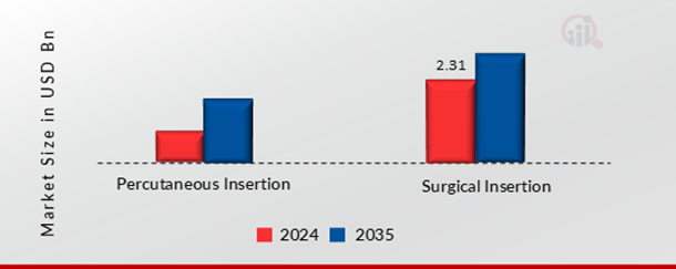Implantable Port Market, By Insertion Method, 2024 & 2035 