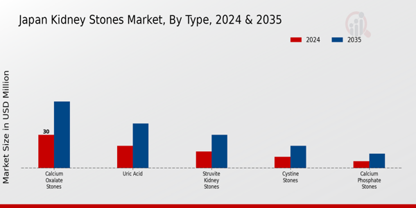 Japan Kidney Stones Market Segment