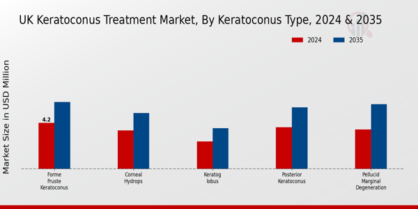 UK Keratoconus Treatment Market Segment