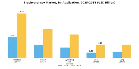 Brachytherapy Market Segment Image 0