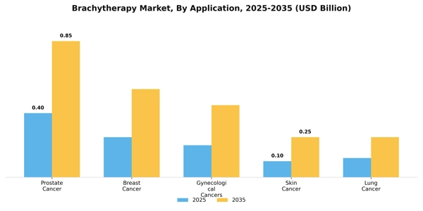 Brachytherapy Market Segment Image 0