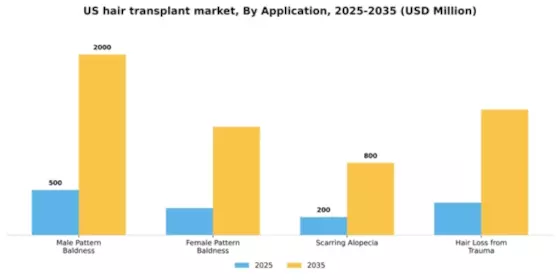 US Hair Transplant Market Segment Image 0