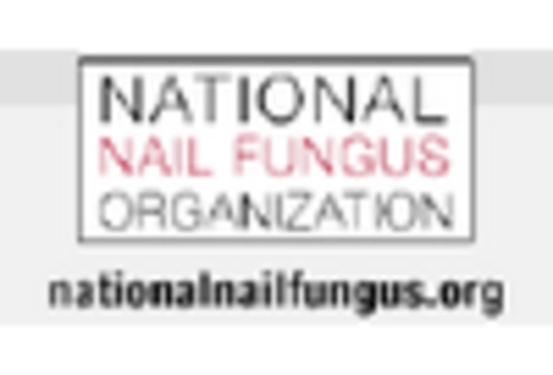 US Construction Nails Market key player