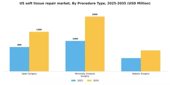 US Soft Tissue Repair Market Segment Image 3