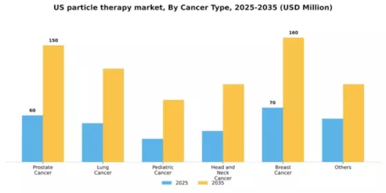 US Particle Therapy Market Segment Image 1