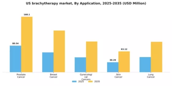 US Brachytherapy Market Segment Image 0