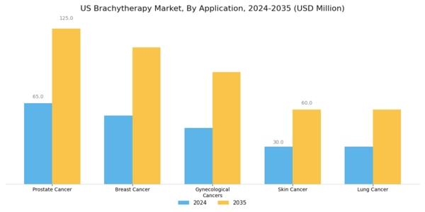 US Brachytherapy Market Segment Image 0