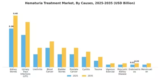 Hematuria Treatment Market Segment Image 0