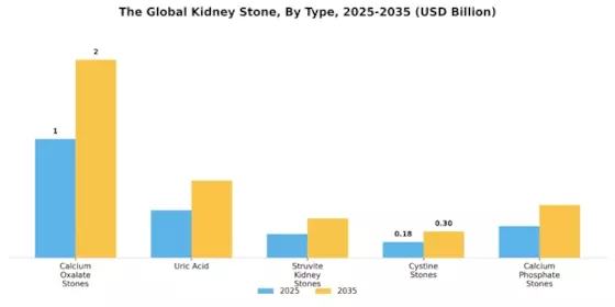 Kidney Stones Market Segment Image 0