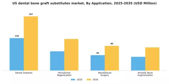 US Dental Bone Graft Substitutes Market Segment Image 0