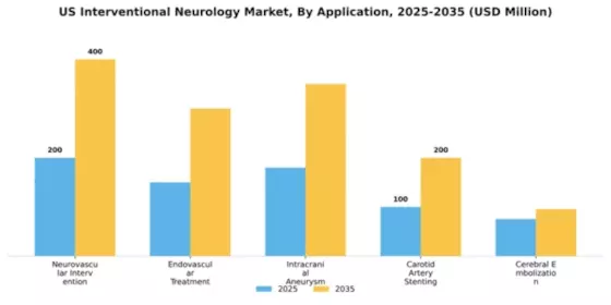 US Interventional Neurology Market Segment Image 0