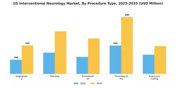 US Interventional Neurology Market Segment Image 3