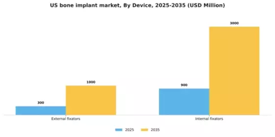 US Bone Implant Market Segment Image 2
