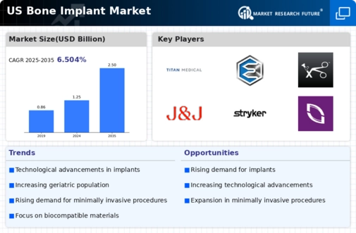 US Bone Implant Market Infographic