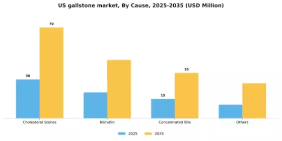 US Gallstone Market Segment Image 0