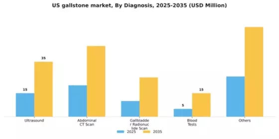 US Gallstone Market Segment Image 1
