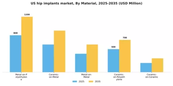 US Hip Implants Market Segment Image 1