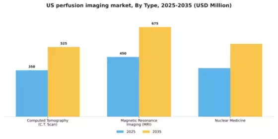 US Perfusion Imaging Market Segment Image 1