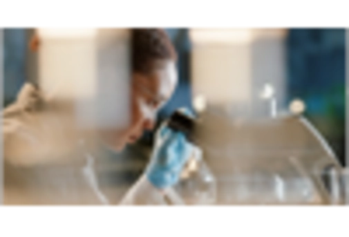 US Carotenoids Market  key player