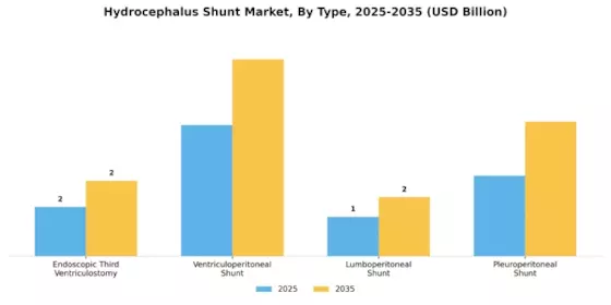 Hydrocephalus Shunt Market Segment Image 1