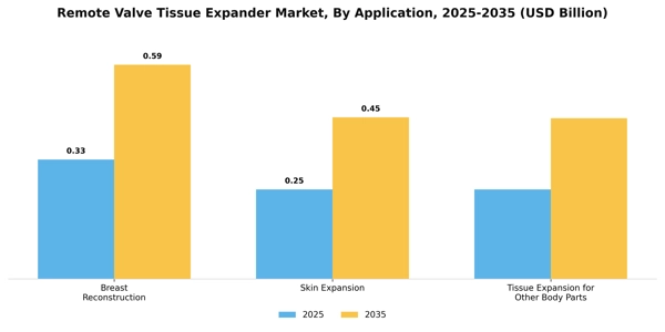Remote Valve Tissue Expander Market Segment Image 0