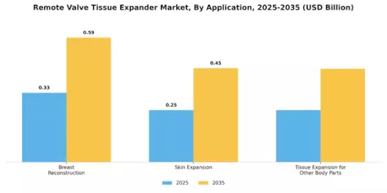 Remote Valve Tissue Expander Market Segment Image 0