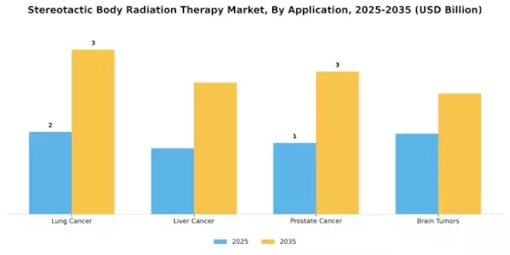 Stereotactic Body Radiation Therapy Market Segment Image 1
