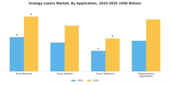 Urology Lasers Market Segment Image 0