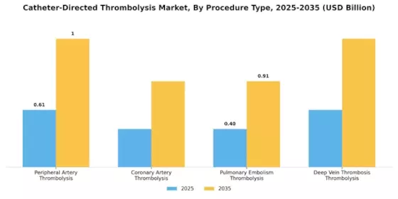 Catheter Directed Thrombolysis Market Segment Image 3