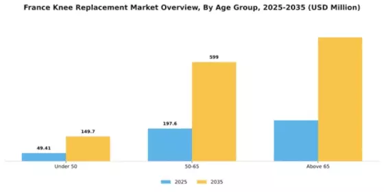 France Knee Replacement Market Segment Image 0