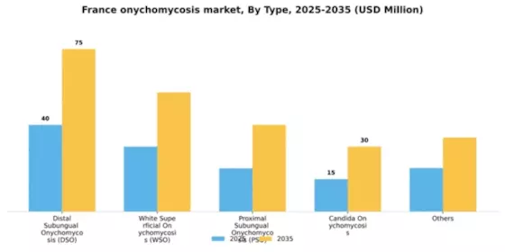 France Onychomycosis Market Segment Image 2