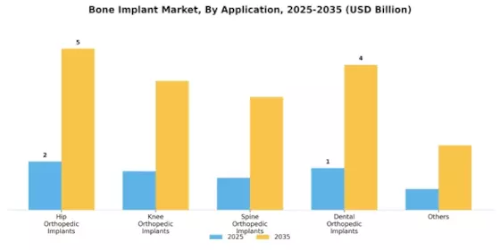 Bone Implant Market Segment Image 0