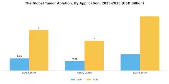 Tumor Ablation Market Segment Image 2